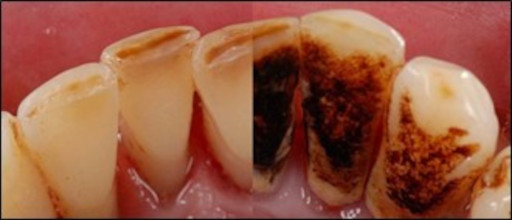 zunanje zabarvanje zob